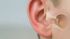 Otitis media aguda: síntomas de infección de oído y cuándo llevar a tu hijo al médico